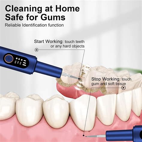 Buy Plaque Remover for Teeth, Home Dental Care Kits, Teeth Cleaning Kit ...