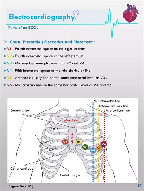 Ecg interpretation | PDF
