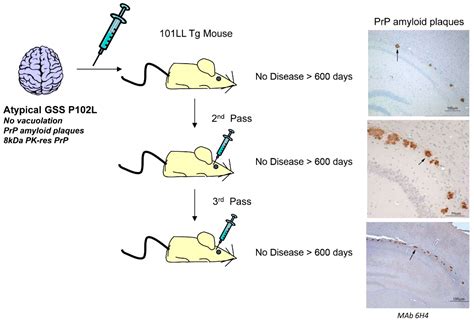 what is gss disease Baseline radiographic - Diseases Club center