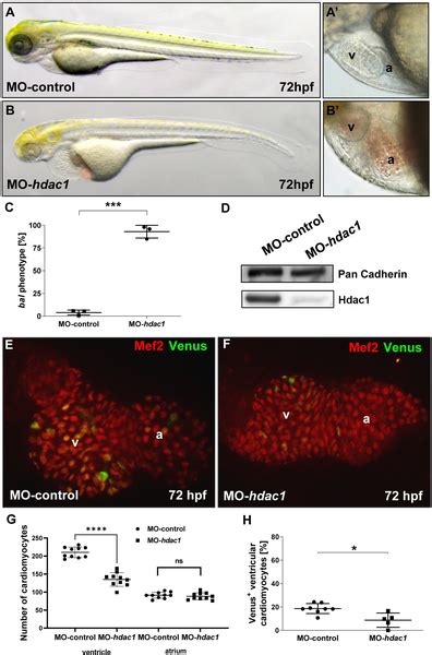 Image result for Zebrafish Embryo Development Heart