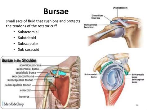 SHOULDER PAIN Diff. Diagnosis RB.pptx