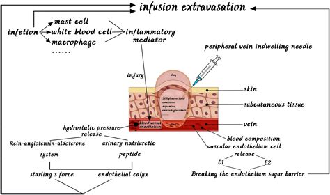 Infiltration Of Iv Line