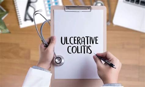 FDA Approves Guselkumab as First IL-23 Inhibitor with Both SC and IV ...