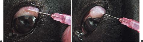 Subconjunctival Injection 的图像结果