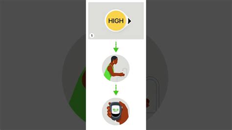 Image result for Dexcom Update