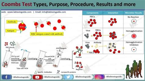 Image result for Coombs Test