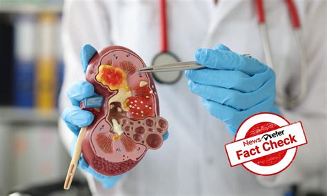 Fact Check: Can a concoction of olive oil, honey and lemon juice ...