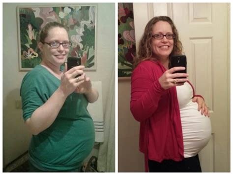 Twin vs. Single Bump Comparison | BabyCenter