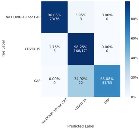 Automatic COVID-19 and Common-Acquired Pneumonia Diagnosis Using Chest ...