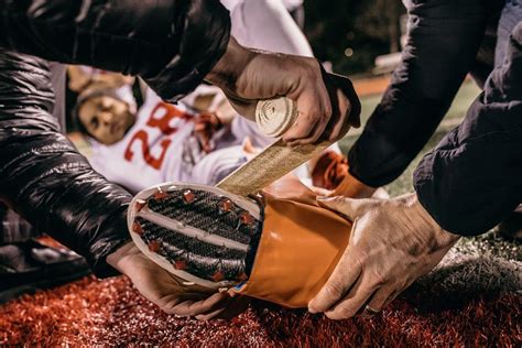 Image result for Sam Splint Vs Other Splints