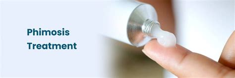 درمان فیموزیس: گزینه هایی برای تسکین و بهبودی