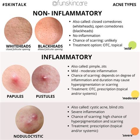 Types Of Acne Chart