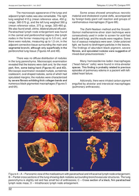 Paratracheal Lymph Nodes In Lungs