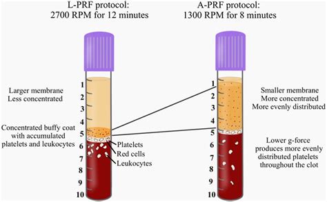 PRF Protocol 的图像结果