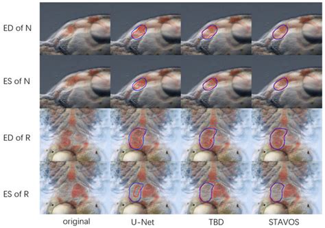 STAVOS: A Medaka Larval Cardiac Video Segmentation Method Based on Deep ...