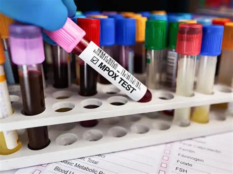 Pharma News: Latest Pharmaceuticals exclusive stories on ETPrime