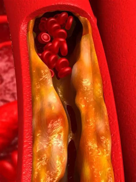 చెడు కొవ్వును కరిగించి మంచి కొవ్వును పెంచే ఆహారాలు | TeluguSamayam