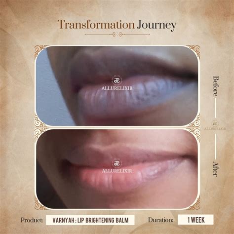 Varnyah Lip Brightening Balm | Nourish & Lighten Dark Lips Naturally ...