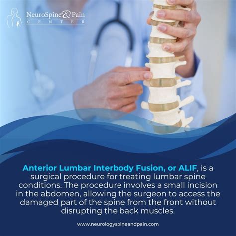 Anterior Lumbar Interbody Fusion (ALIF) - Neuro Spine & Pain Center