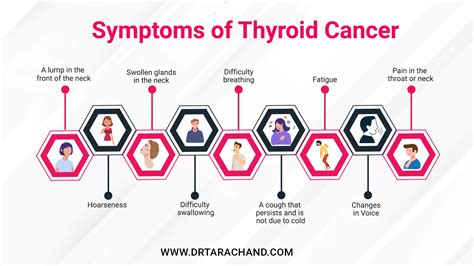 Thyroid Cancer Young at Stephanie Le blog
