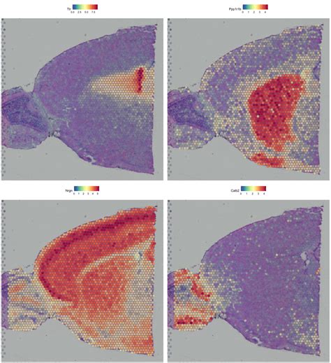 Spatial Transcriptomics 的图像结果