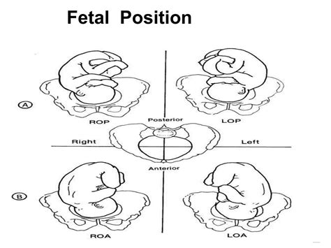 NORMAL LABOUR& Mechanism.pptx