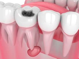 RVS DENTAL COLLEGE AND HOSPITAL | Best Dental Colleges in coimbatore