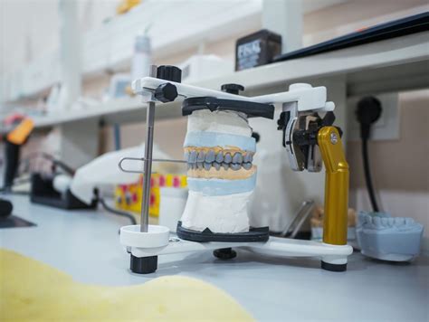 Tips In Choosing The Best Type of Dental Crown for Your Dental Needs - Confident Dental Lab ...