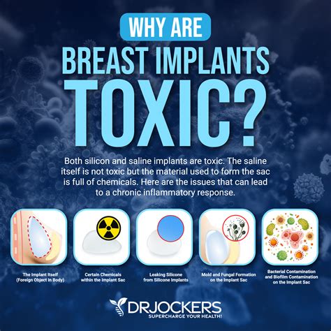 Breast Implant Illness: Symptoms and Recovery Support