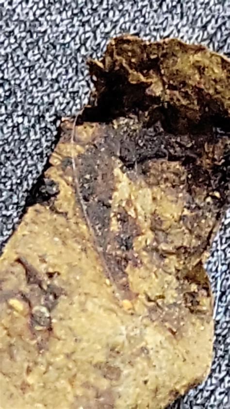 dead liver flukes in stool? : r/ClinicalMicrobiology