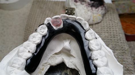 Image result for Compression Spring Retainer