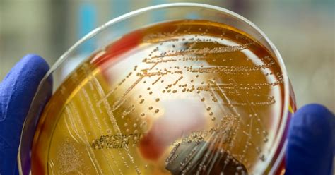 STREP 的图像结果