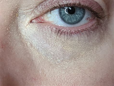 Get The ‘why could my concealer be doing this (and drying badly). is there an under eye prep ...