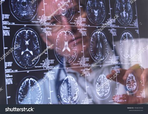 Image result for Human Brain Scan