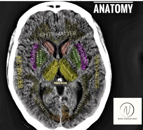 Ct Brain Anatomy Images