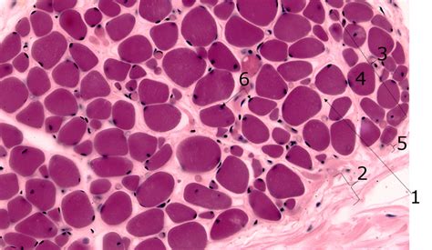 Image result for Skeletal Muscle Flow Chart