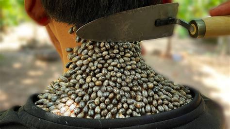 Image result for Insect Removal From Humans