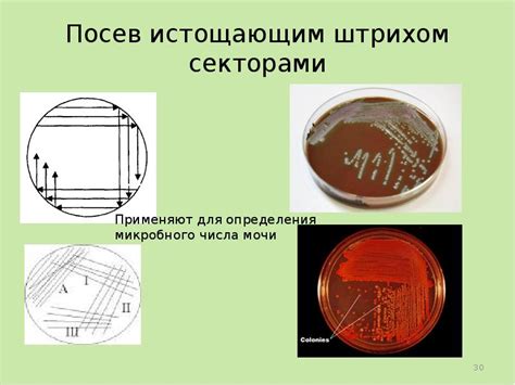 Питательные среды для медицинской микробиологии. Методы и техники посевов