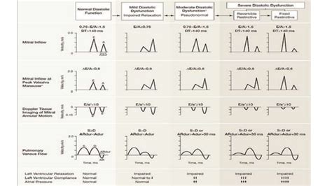Left ventricular diastolic dysfunction in echocardiography | PPTX ...