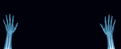 Image result for Normal Hand