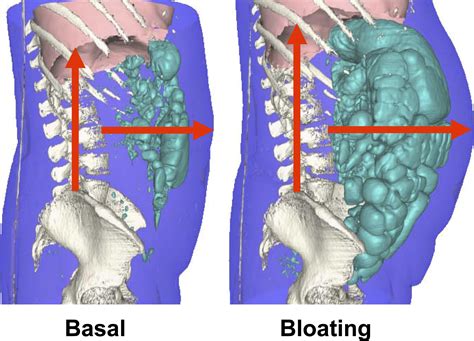 Abdominal Ventral Definition at Joe Alvarez blog