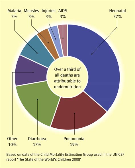 Malnutrition in developing countries - Paediatrics and Child Health