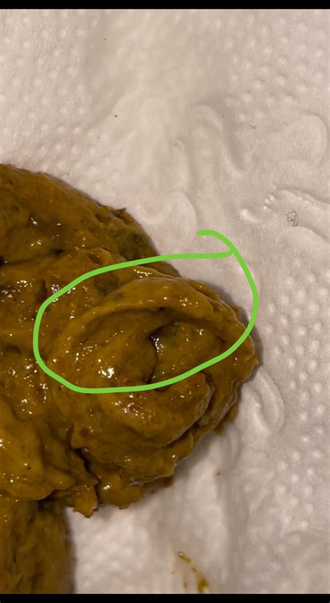 Image result for Poop Out of a Tree