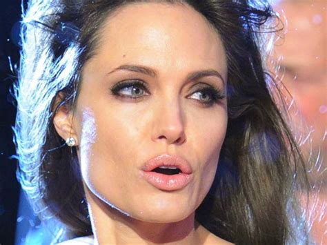 Kuvatulokset haulle celebrities with lips done