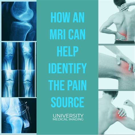 #umimri #mri #t3mri #medicalimaging #universitymedicalimaging #yourimageiseverythingtous # ...