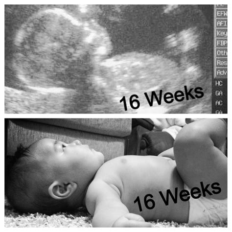 Ultrasound 16 Week