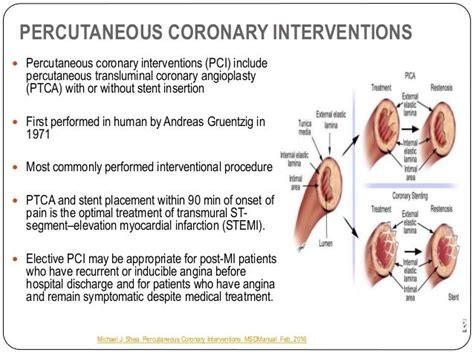 PCI Treatment 的图像结果
