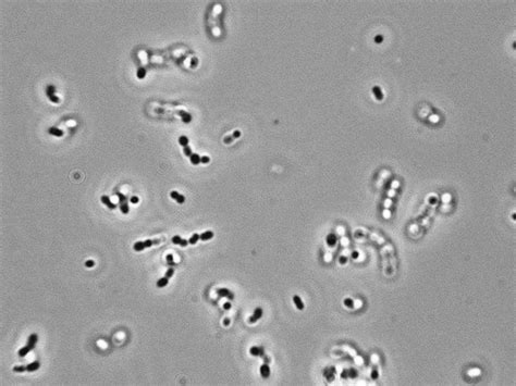 Bacteria Reproducing Under a Microscope 的图像结果