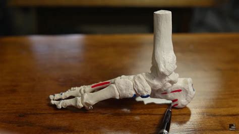 Plantar Fasciitis 的图像结果