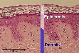 Image result for epidermis